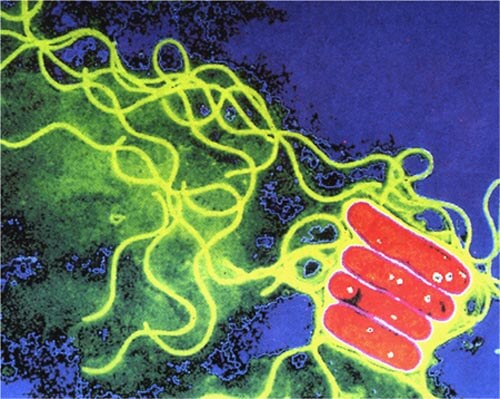 Batterio Legionella